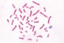 Kromosomer fra menneske, metafase