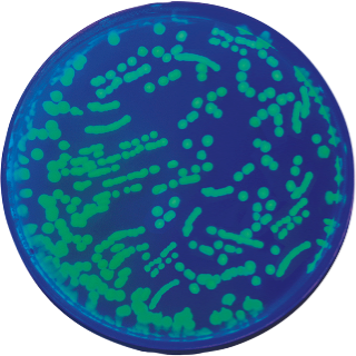 Transformasjon av E. coli med GFP