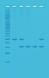 PCR-basert analyse av DNA-profiler